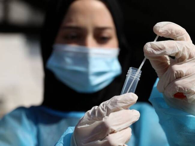 Covid 19 test. Créditos: Getty Images